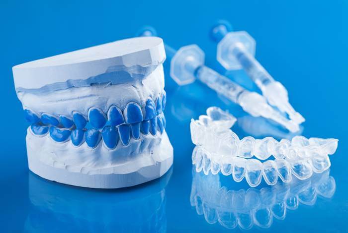 blanqueamiento-dental-combinado-barcelona