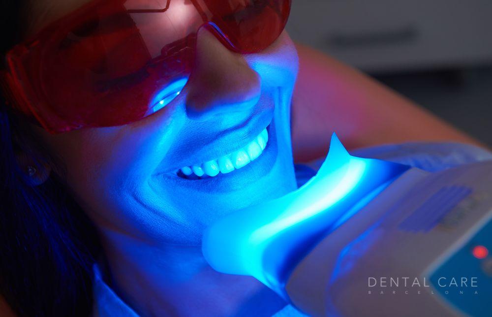 Blanqueamiento con ortodoncia: La sonrisa perfecta en Dental Care Barcelona