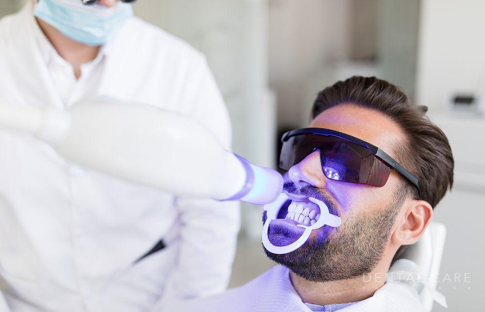 Claves para garantizar un blanqueamiento dental efectivo en Dental Care Barcelona